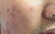 Siết chặt dịch vụ làm đẹp bình dân