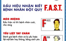 1 tuần nghỉ Tết, hơn 300 người đột quỵ cấp cứu tại Bệnh viện Nhân dân 115