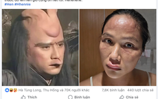 H'Hen Niê tiết lộ bị nổi mề đay sau sinh, bác sĩ nói gì về tình trạng này?