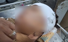 Nghi vấn nữ cán bộ xã ở Đồng Tháp rạch mặt người phụ nữ nhậu với chồng
