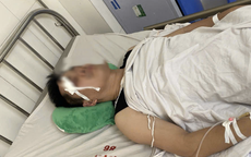 Xe buýt va chạm nhẹ với xe con, tài xế bị đánh chấn thương sọ não