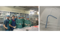 Ống thông truyền hóa chất bị bỏ quên suốt 3 năm, đứt trôi vào tim người phụ nữ