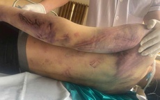 Tạm giữ 8 người liên quan đến vụ học viên 17 tuổi tử vong tại trung tâm công tác xã hội