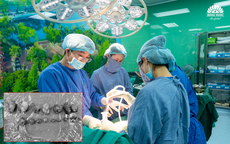 Bóc 18 khối u xơ, bảo toàn tử cung cho bệnh nhân