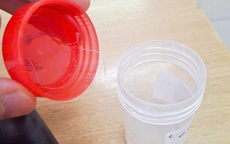 Sinh vật lạ dài gần 10 cm trong mắt người phụ nữ