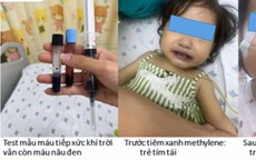 Dùng nước giếng nấu ăn, máu của bé gái chuyển nâu