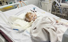 Bé trai xuất huyết não bất thường khi gửi ở nhóm nhà trẻ tự phát