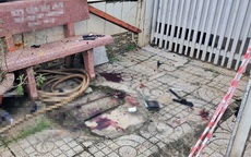 Bàn tay và đùi người đàn ông dập nát sau tiếng nổ lớn