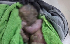 Cứu sống trẻ sơ sinh bị bỏ rơi đã ngừng tim, người đầy bùn đất