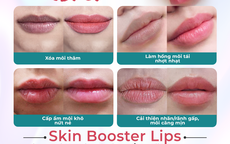 Top 3 nơi "trẻ hóa môi" uy tín tại TPHCM