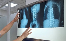 Bộ Y tế đề nghị không lấy thời gian chụp X-quang để từ chối BHYT