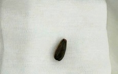 Bé 3 tuổi nguy kịch vì loại hạt thường có trên bàn tiếp khách dịp Tết