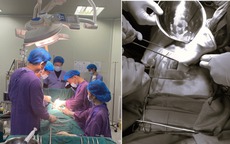 Dọn nhà đón Tết, người đàn ông ngã từ trên cao xuống, nguy kịch