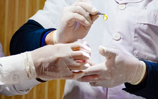 Biết mình không còn nhiều thời gian, cô gái 26 tuổi hiến giác mạc