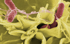 TPHCM: Tình trạng học sinh nghi ngộ độc thực phẩm tại Trường Bình Quới Tây hiện ra sao?