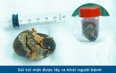 Đi khám sức khỏe định kỳ, người phụ nữ trẻ phát hiện điều bất ngờ