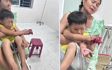 Cháu bé bị dập bàn tay nghi do điện thoại nổ lúc sạc pin