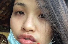 Diễm Hương lo sợ sau khi tố cáo 'bị chồng hành hung'