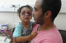 Trúng tên lửa Israel, bé gái Palestine bị ném lên không trung