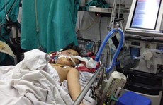 Bé 8 tuổi bị bố đánh dã man bằng điếu cày đã tử vong
