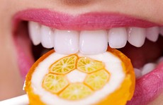 6 thực phẩm bổ dưỡng bất ngờ gây hại cho răng