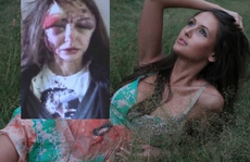 Người mẫu Nga bị bạn trai triệu phú đánh dã man