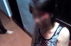 Bị chồng đánh dã man, một phụ nữ bị sẩy thai