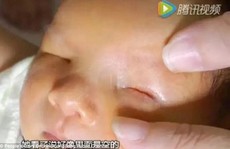 'Em bé không mắt” ở Trung Quốc