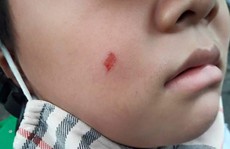 Giáo viên xông vào trường tát cô giáo