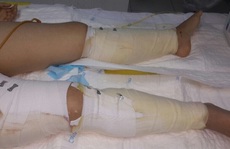 Cô gái 18 tuổi vụ sập nhà ở Cửa Bắc không phải cưa chân