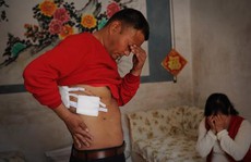 Trung Quốc: Mổ ngực xong, phát hiện... mất thận