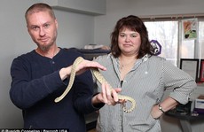 Cho rắn độc cắn 160 lần để tìm thuốc giải