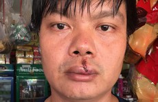 Xông vào nhà đập phá, hành hung người tố cáo ô nhiễm?