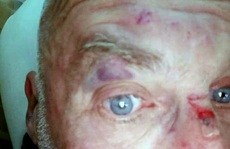 Công an điều tra vụ du khách Hà Lan bị hành hung ở Sa Pa