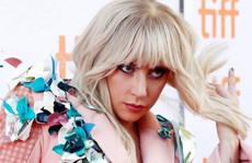 Lady Gaga hoãn lưu diễn đến 2018 vì đau xơ cơ