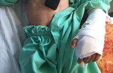 Một cậu bé 14 tuổi bị máy cắt lìa bàn tay