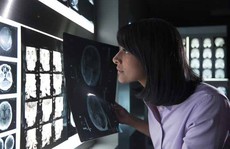 Trí tuệ nhân tạo xung trận chống ung thư