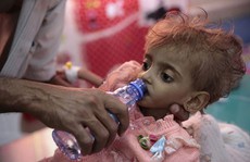 Nạn đói thế kỷ ở Yemen