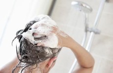 6 cách ngăn ngừa mụn mọc trên da đầu cực hiệu quả