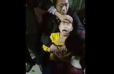 Bác sĩ nói gì về hiện tượng bé trai nghi phát bệnh dại kêu 'oắc oắc'?