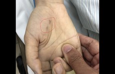 Chẩn đoán nhầm bệnh thú cưng, nữ bác sĩ trẻ tử vong do chó cắn