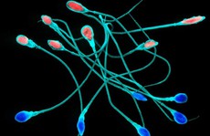 Liệu pháp 'sốc điện' tinh trùng sinh con siêu nhân gây tranh cãi