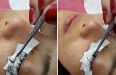 Cô gái Thái Lan suýt hỏng mắt vì nối mi bằng keo dán sắt