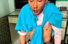 Vụ cha dượng đốt 3 người ở Đồng Nai: Hai cháu bé đã tử vong