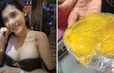 Những chuyện bi hài mang tên túi ngực silicone