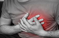 Có biểu hiện nhận biết cơn đau thắt ngực đe dọa nhồi máu cơ tim?