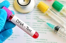 Cháu nội giống “ông hàng xóm”, tôi có nên đi thử ADN?