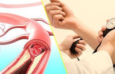'Chuyện ấy' với người bị tăng huyết áp, thắc mắc không phải ai cũng dám hỏi