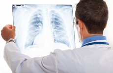 Hơn 6 triệu người mắc bệnh hen và COPD