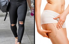 Hạn chế diện 7 loại trang phục này nếu không muốn sức khỏe đi xuống